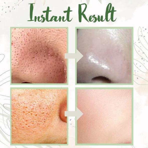 Final Sale - Green Tea Deep Cleanse Mask - （Limited time discount 🔥 last day）